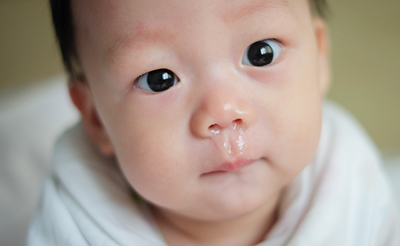 【小児科医監修】赤ちゃんの鼻水をスッキリ解決！鼻水の原因や吸引器の使い方・選び方をお答えします