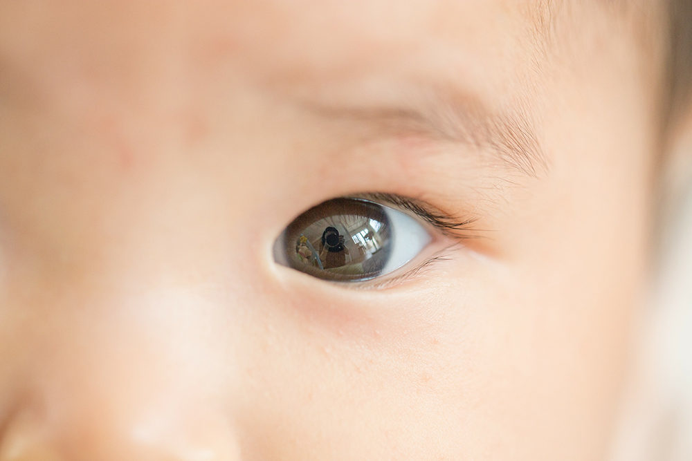 眼科医監修】新生児の「目やに」の原因別の特徴と上手な取り方