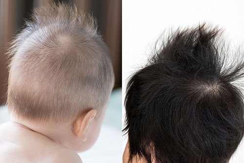 柔らかい産毛（左）としっかりした髪の毛（右）