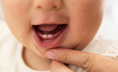 赤ちゃんの歯が生える前兆8つと生えてこないときの受診目安
